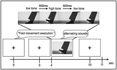 High Amplitude EEG Motor Potential during Repetitive Foot Movement: Possible Use and Challenges for Futuristic BCIs That Restore Mobility after Spinal Cord Injury